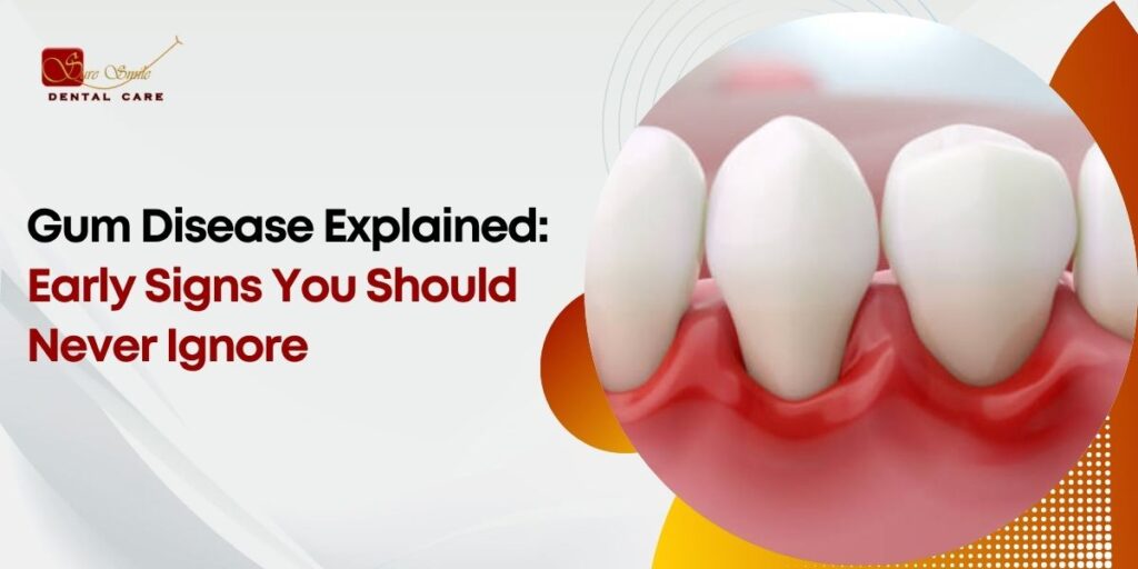 Gum Disease Explained Early Signs You Should Never Ignore