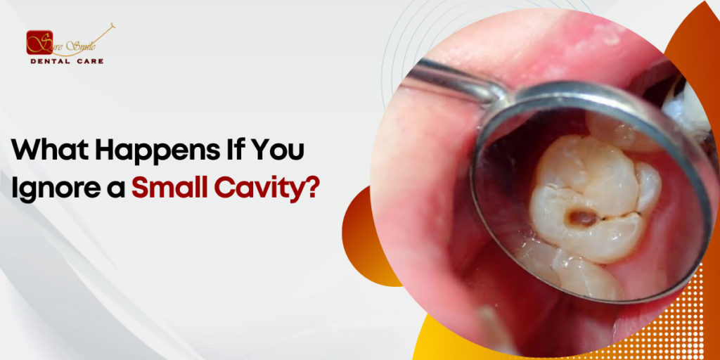 Cavity Treatment Bangalore