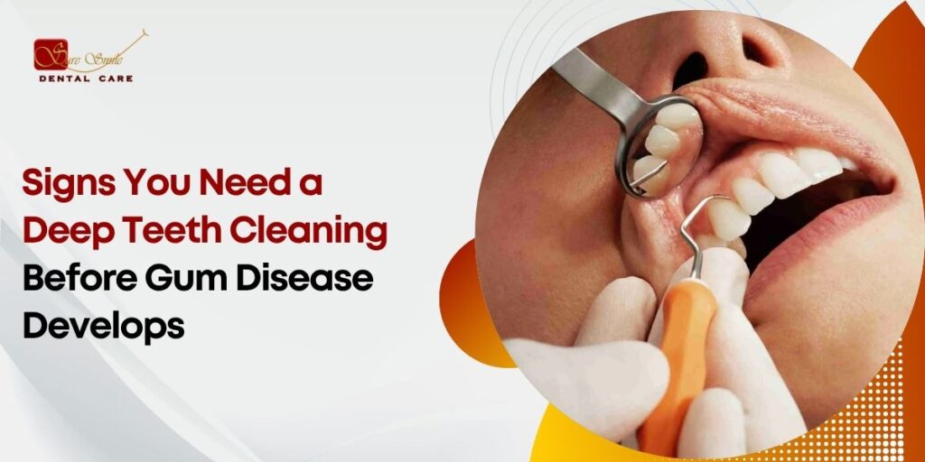 Signs You Need a Deep Teeth Cleaning Before Gum Disease Develops
