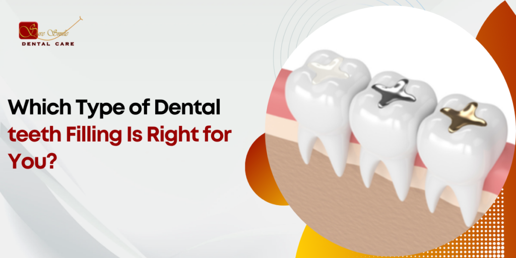 Which Type of Dental teeth Filling Is Right for You