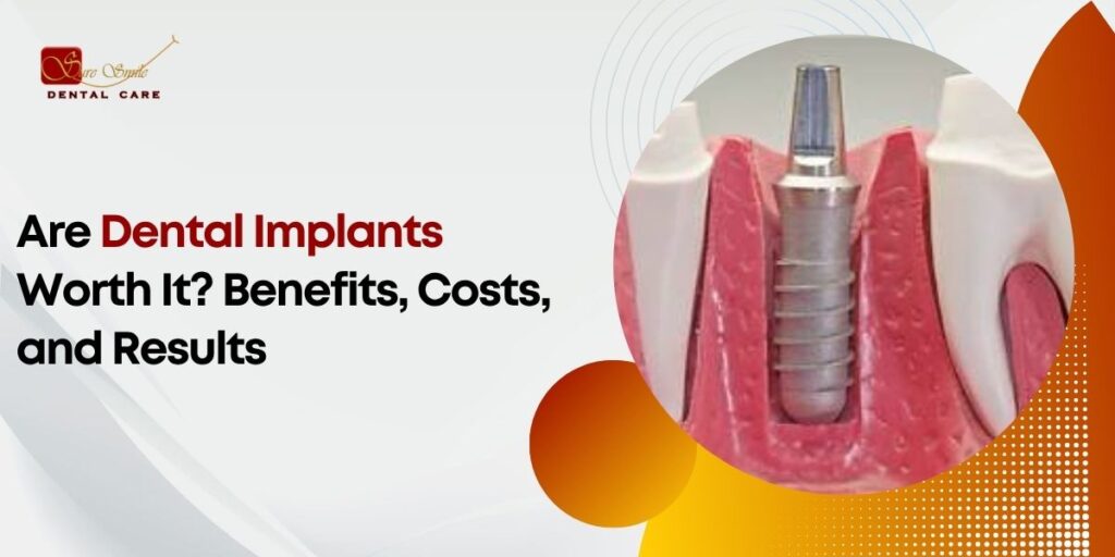 Are Dental Implants Worth It Benefits, Costs, and Results