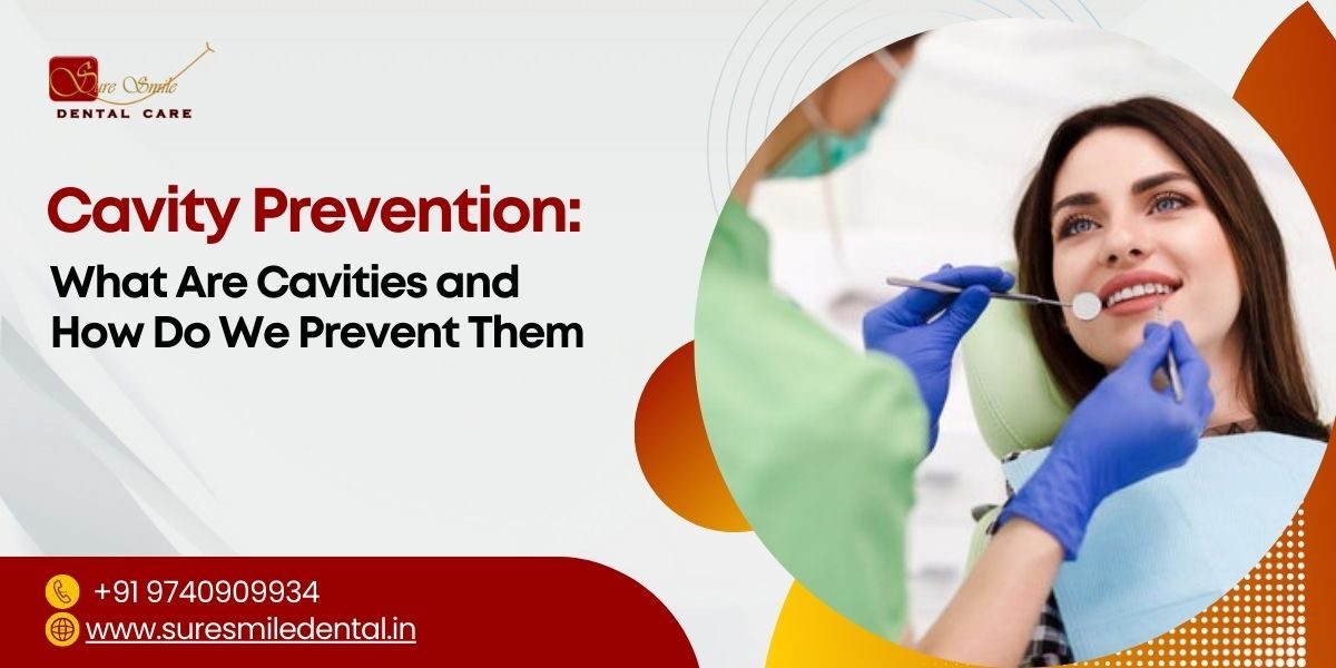 Cavity Prevention
