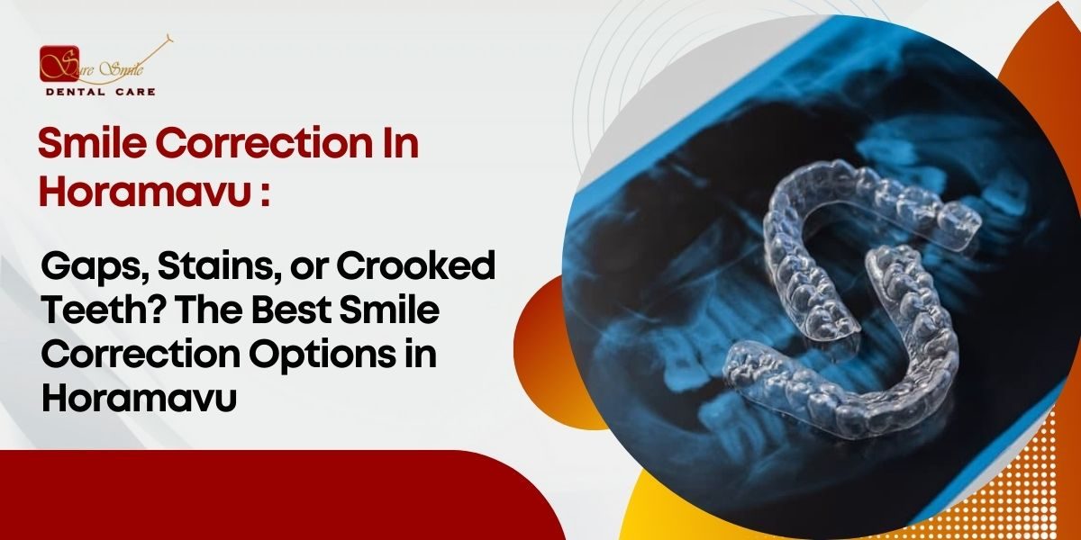 Gaps, Stains, or Crooked Teeth The Best Smile Correction Options in Horamavu