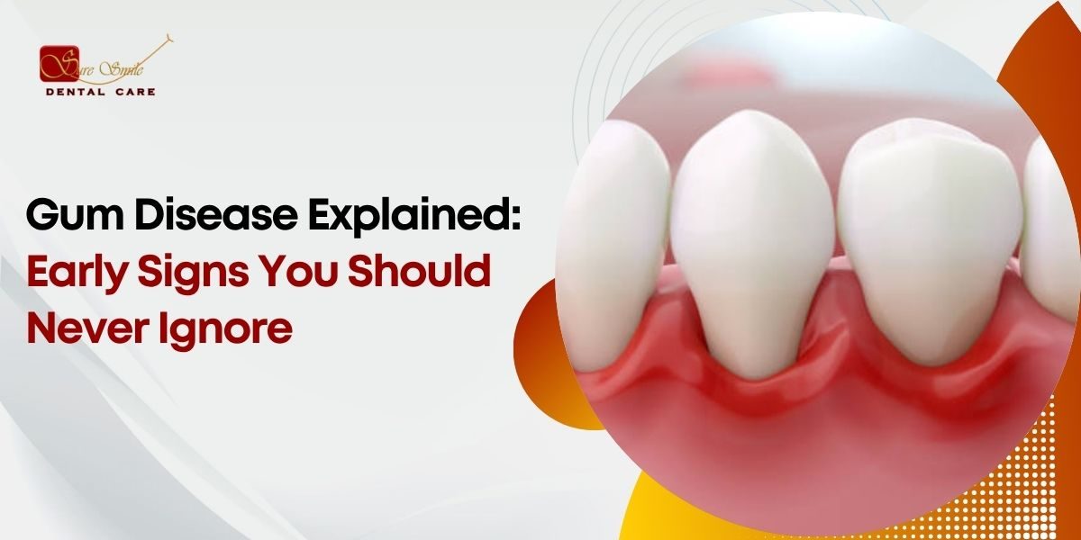 Gum Disease Explained Early Signs You Should Never Ignore