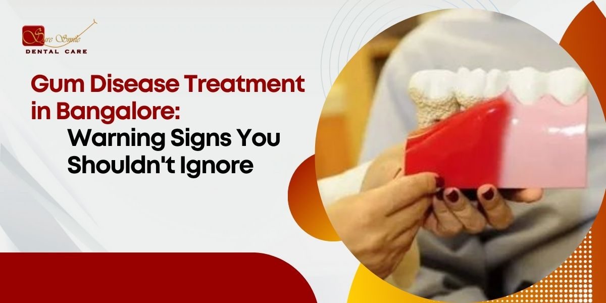 Gum Disease Treatment in Bangalore