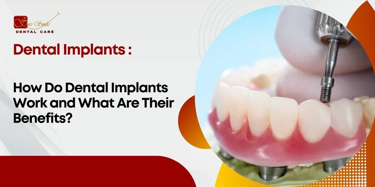 Dental Implants Near Me