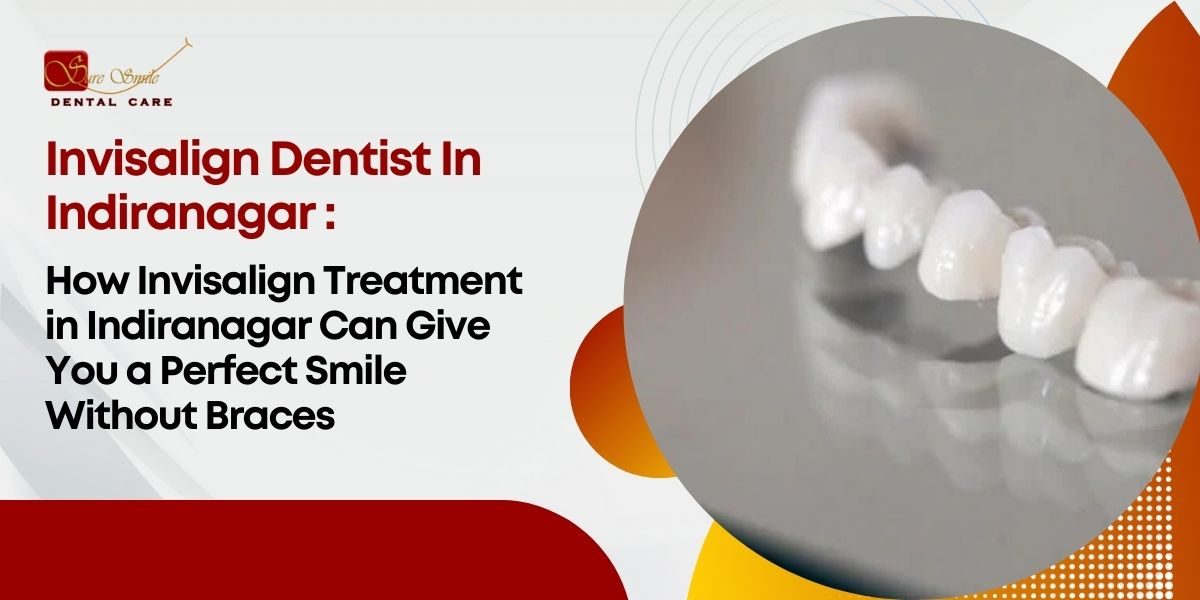 How Invisalign Treatment in Indiranagar Can Give You a Perfect Smile Without Braces