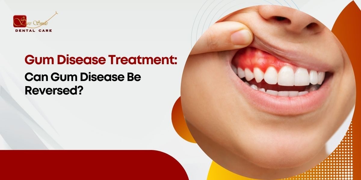 Gum Disease Treatment