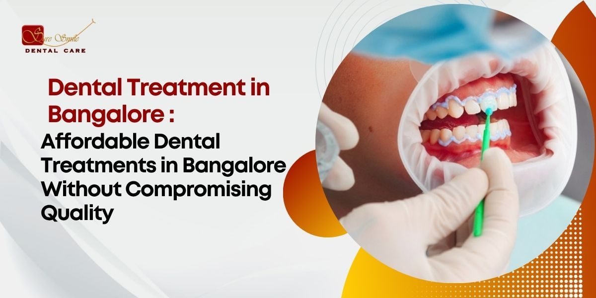Dental treatment in bangalore