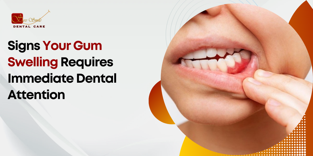 gum swelling treatment in horamavu
