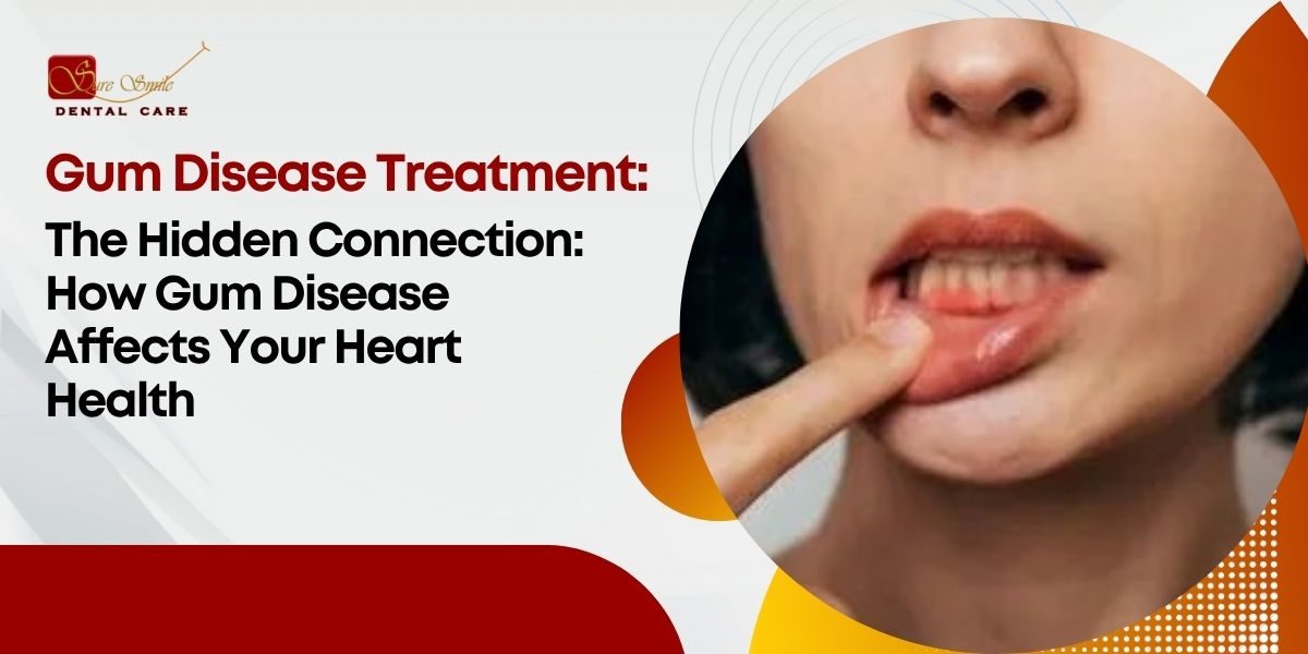 Gum Disease Treatment