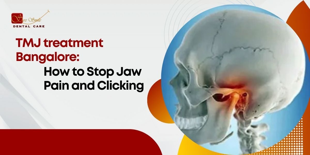TMJ treatment Bangalore