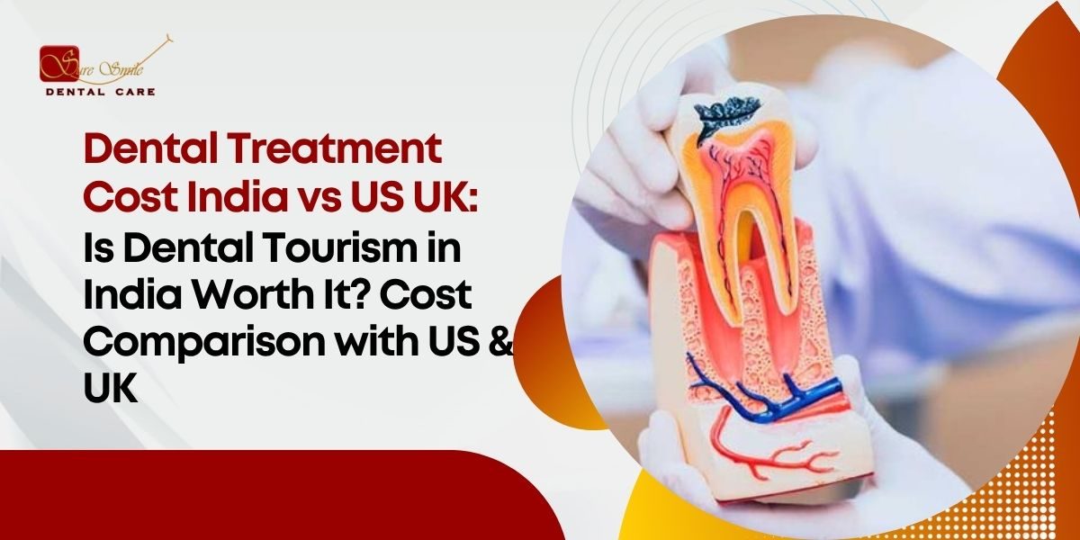 Dental Treatment Cost India vs US UK