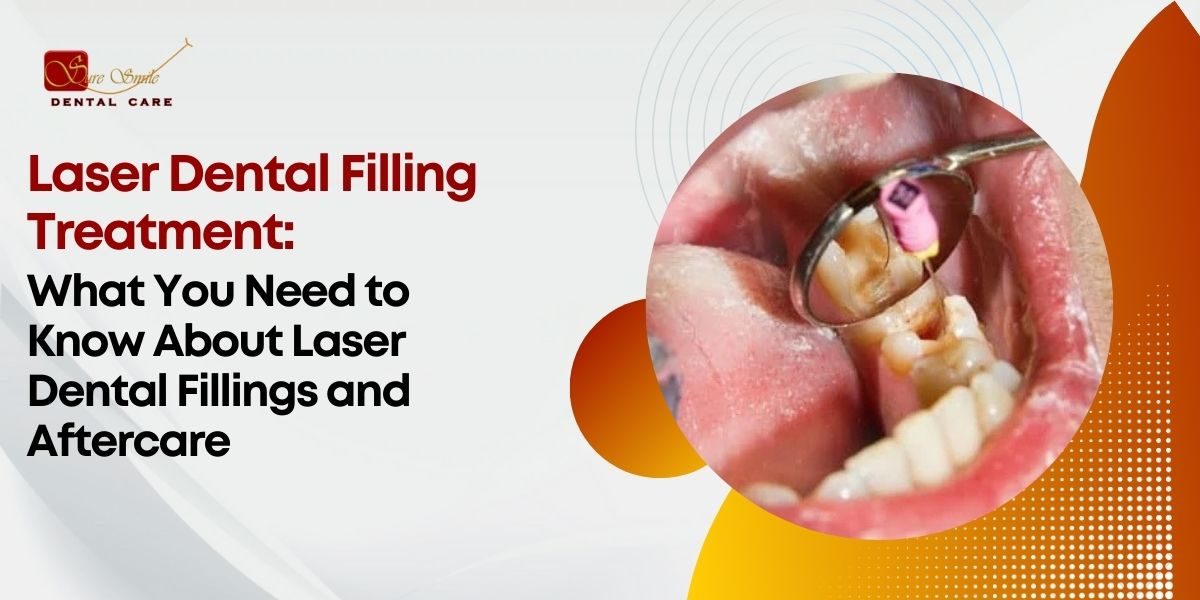 laser dental filling treatment