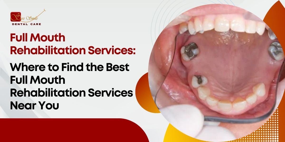 full mouth rehabilitation services