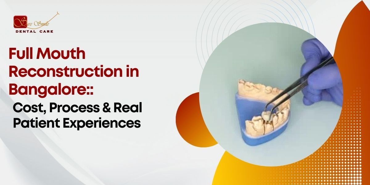 Full Mouth Reconstruction in Bangalore: Cost, Process & Real Patient Experiences